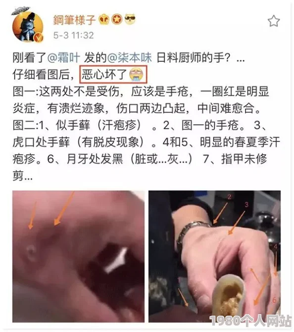 100%露胸该内容因违反社区准则已被移除